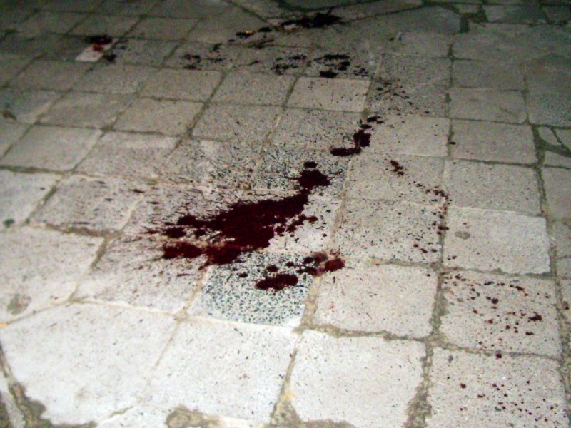 Krew na chodniku- zdjęcie ilustracyjne